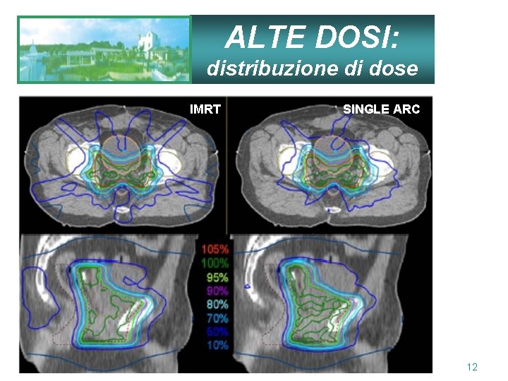 ALTE DOSI: distribuzione di dose IMRT AUr. O Puglia 2011 - Martina Franca SINGLE