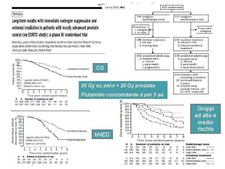 OS 50 Gy su pelvi + 20 Gy prostata Flutamide concomitante e per 3