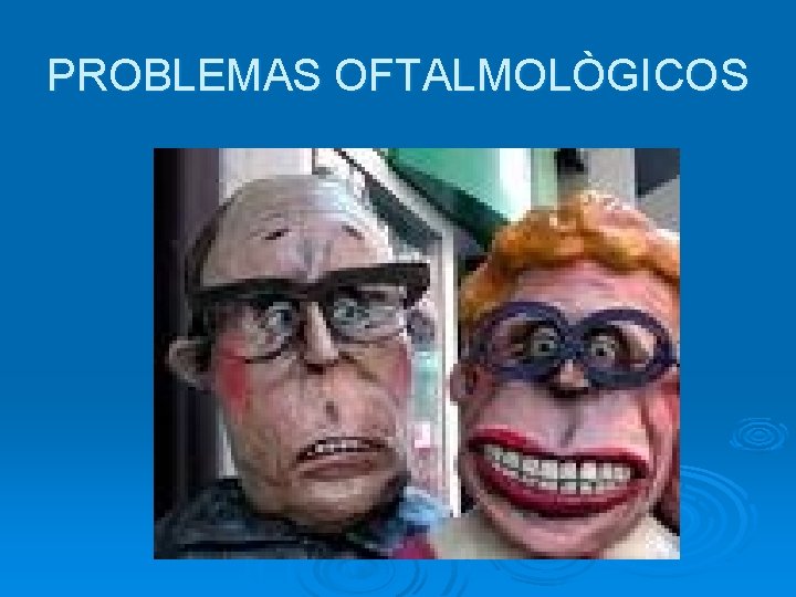 PROBLEMAS OFTALMOLÒGICOS 