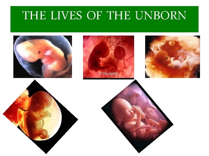 THE LIVES OF THE UNBORN 
