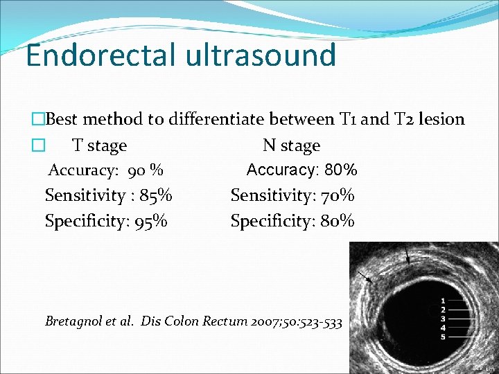Endorectal ultrasound �Best method to differentiate between T 1 and T 2 lesion �