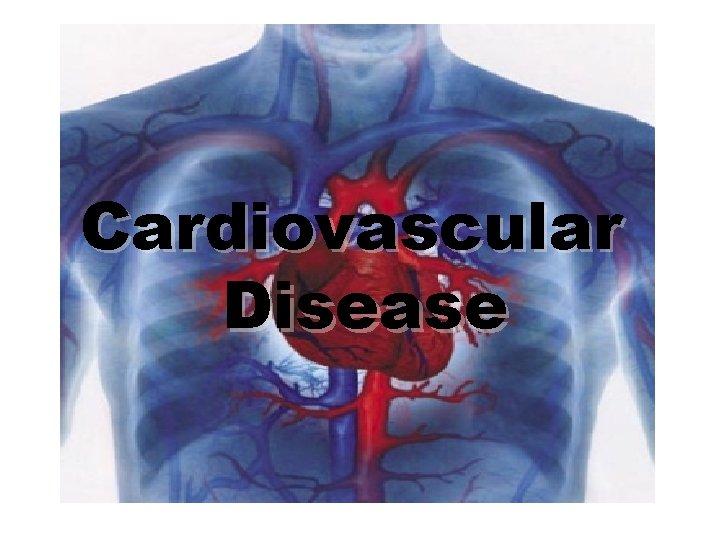 Cardiovascular Disease 