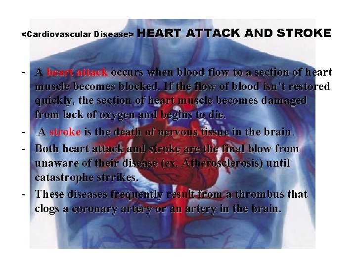 <Cardiovascular Disease> HEART ATTACK AND STROKE - A heart attack occurs when blood flow