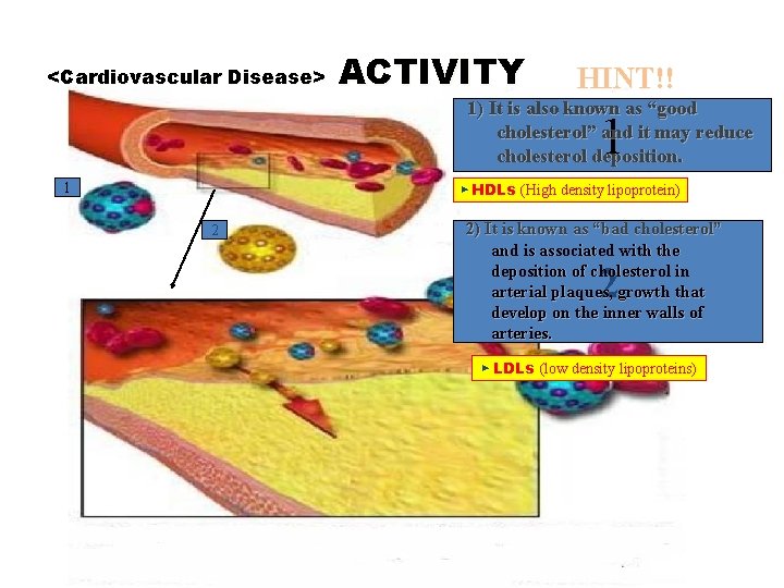 <Cardiovascular Disease> ACTIVITY HINT!! 1) It is also known as “good cholesterol” and it