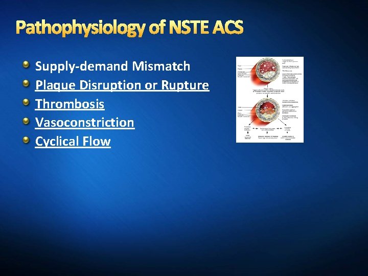 Pathophysiology of NSTE ACS Supply-demand Mismatch Plaque Disruption or Rupture Thrombosis Vasoconstriction Cyclical Flow