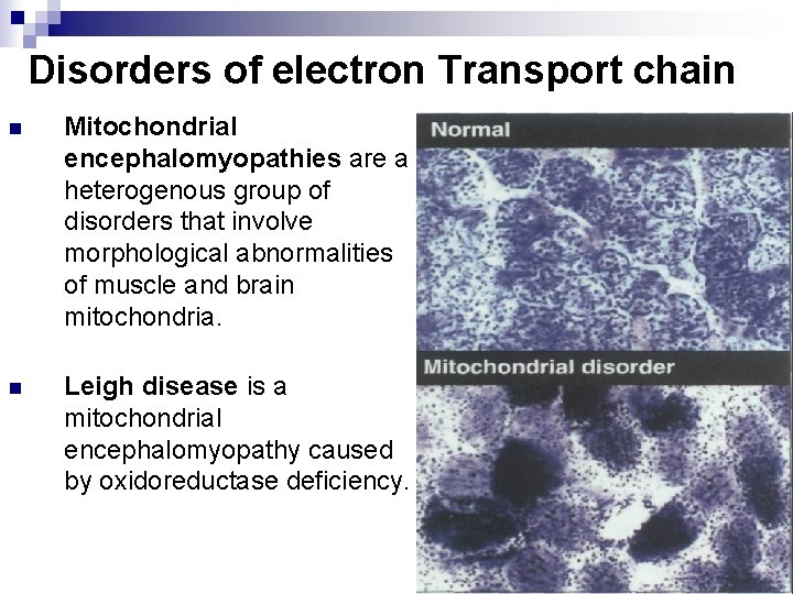 Disorders of electron Transport chain n Mitochondrial encephalomyopathies are a heterogenous group of disorders