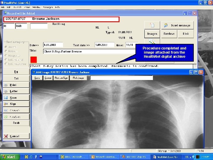 Procedure completed and image attached from the Health. Net digital archive 