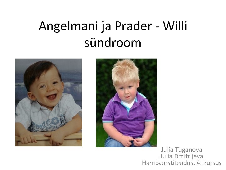 Angelmani ja Prader - Willi sündroom Julia Tuganova Julia Dmitrijeva Hambaarstiteadus, 4. kursus 