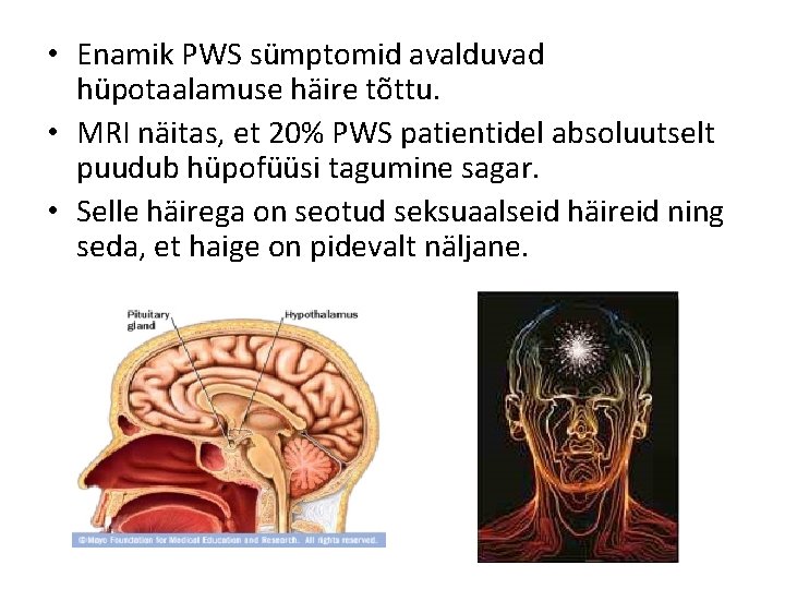  • Enamik PWS sümptomid avalduvad hüpotaalamuse häire tõttu. • MRI näitas, et 20%