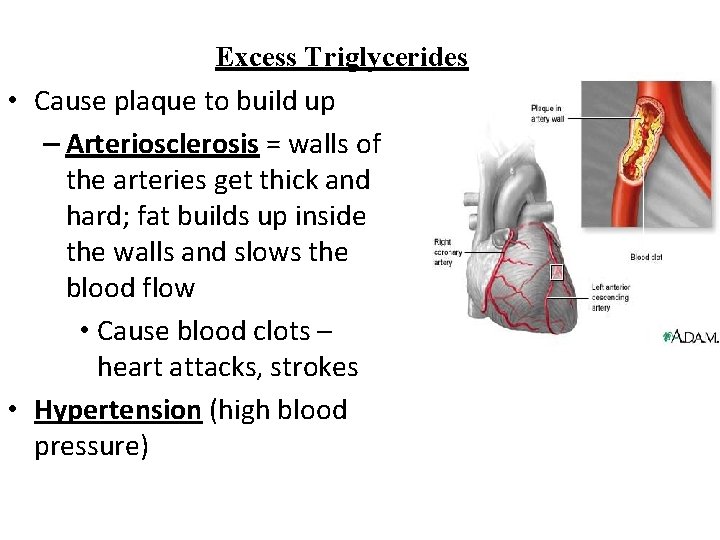 Excess Triglycerides • Cause plaque to build up – Arteriosclerosis = walls of the