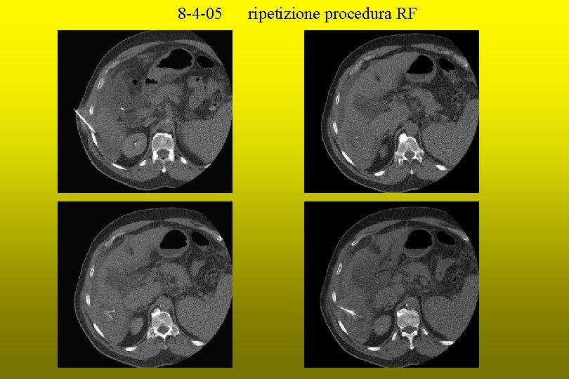 8 -4 -05 ripetizione procedura RF 