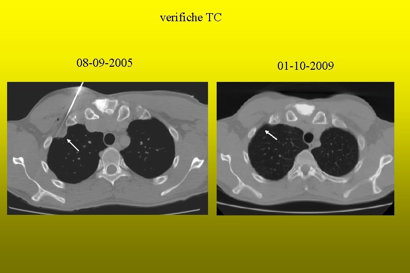 verifiche TC 08 -09 -2005 01 -10 -2009 