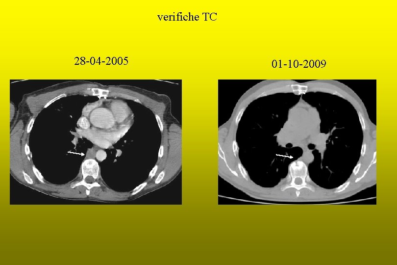 verifiche TC 28 -04 -2005 01 -10 -2009 