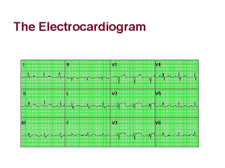 The Electrocardiogram The Electrocardiogram