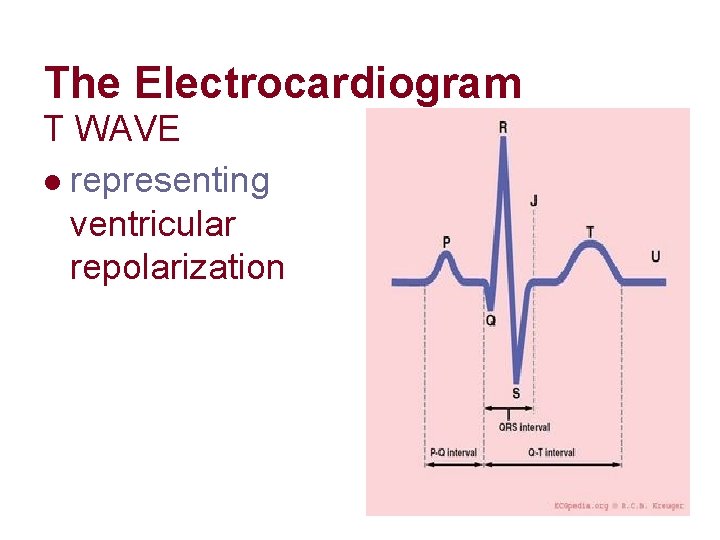 The Electrocardiogram T WAVE l representing ventricular repolarization The Electrocardiogram T WAVE l representing ventricular repolarization