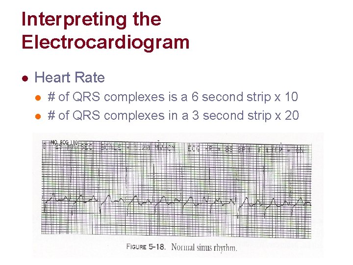 Interpreting the Electrocardiogram l Heart Rate l l # of QRS complexes is a Interpreting the Electrocardiogram l Heart Rate l l # of QRS complexes is a