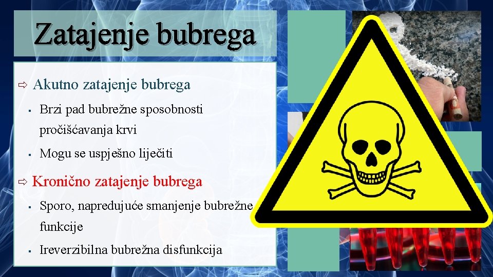 Zatajenje bubrega Akutno § zatajenje bubrega Brzi pad bubrežne sposobnosti pročišćavanja krvi § Mogu