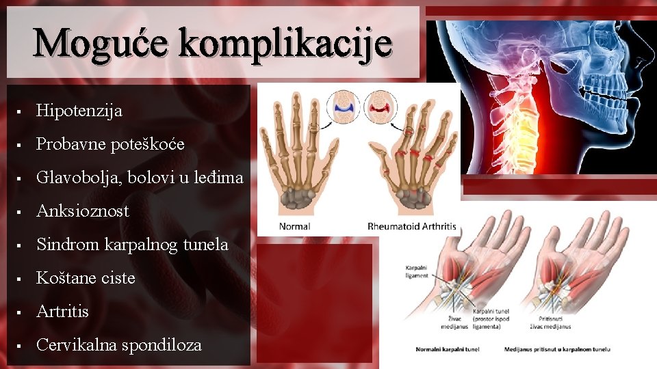 Moguće komplikacije § Hipotenzija § Probavne poteškoće § Glavobolja, bolovi u leđima § Anksioznost