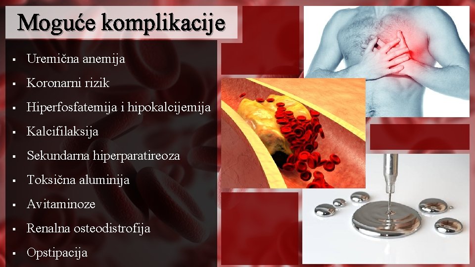 Moguće komplikacije § Uremična anemija § Koronarni rizik § Hiperfosfatemija i hipokalcijemija § Kalcifilaksija