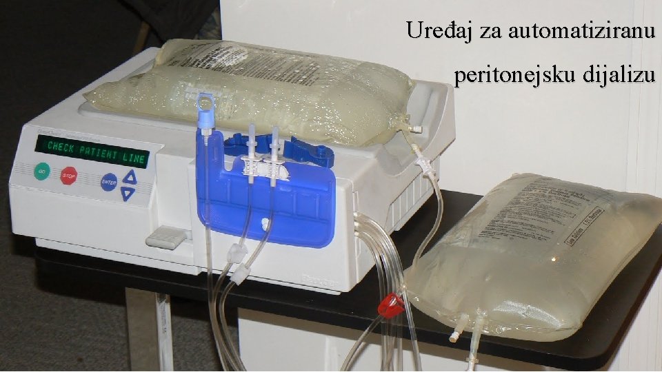 Uređaj za automatiziranu peritonejsku dijalizu 