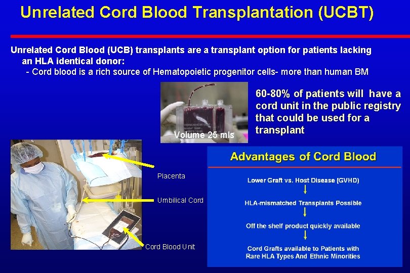 Unrelated Cord Blood Transplantation (UCBT) Unrelated Cord Blood (UCB) transplants are a transplant option