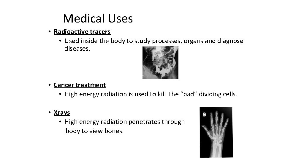 Medical Uses • Radioactive tracers • Used inside the body to study processes, organs