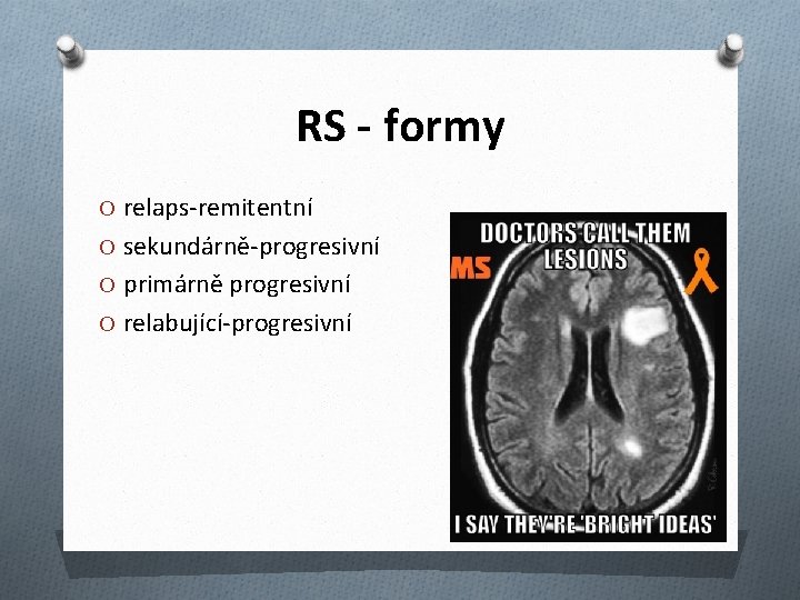 RS - formy O relaps-remitentní O sekundárně-progresivní O primárně progresivní O relabující-progresivní 