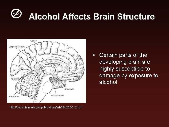 FASD Alcohol Affects Brain Structure • Certain parts of the developing brain are highly