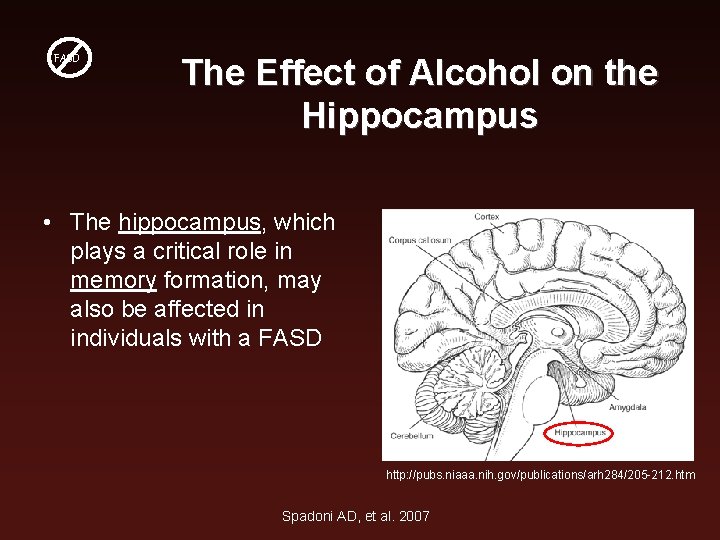 FASD The Effect of Alcohol on the Hippocampus • The hippocampus, which plays a