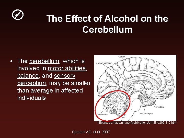 FASD The Effect of Alcohol on the Cerebellum • The cerebellum, which is involved FASD The Effect of Alcohol on the Cerebellum • The cerebellum, which is involved