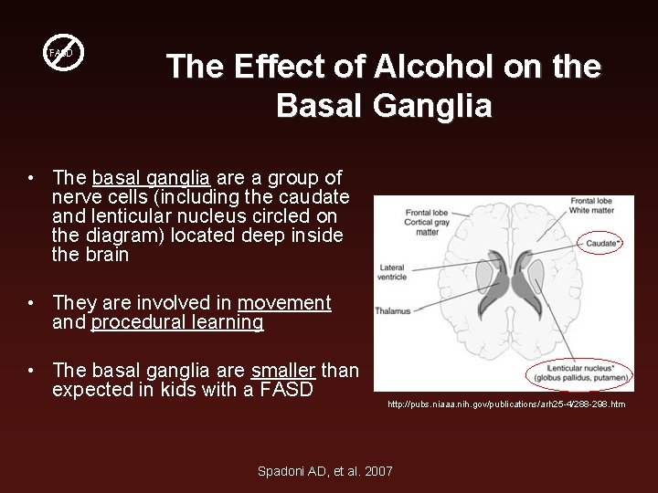 FASD The Effect of Alcohol on the Basal Ganglia • The basal ganglia are