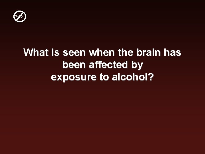 FASD What is seen when the brain has been affected by exposure to alcohol?