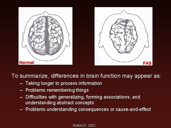 Normal FAS To summarize, differences in brain function may appear as: – Taking longer