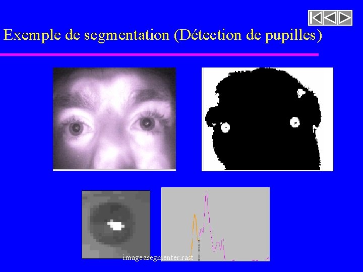 Exemple de segmentation (Détection de pupilles) imageasegmenter. rast 