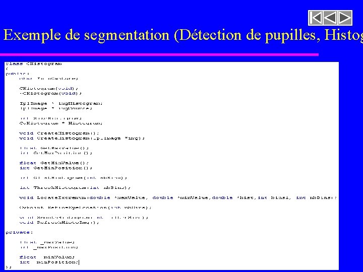 Exemple de segmentation (Détection de pupilles, Histog imageasegmenter. rast 