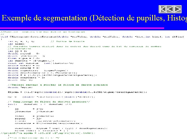 Exemple de segmentation (Détection de pupilles, Histog imageasegmenter. rast 