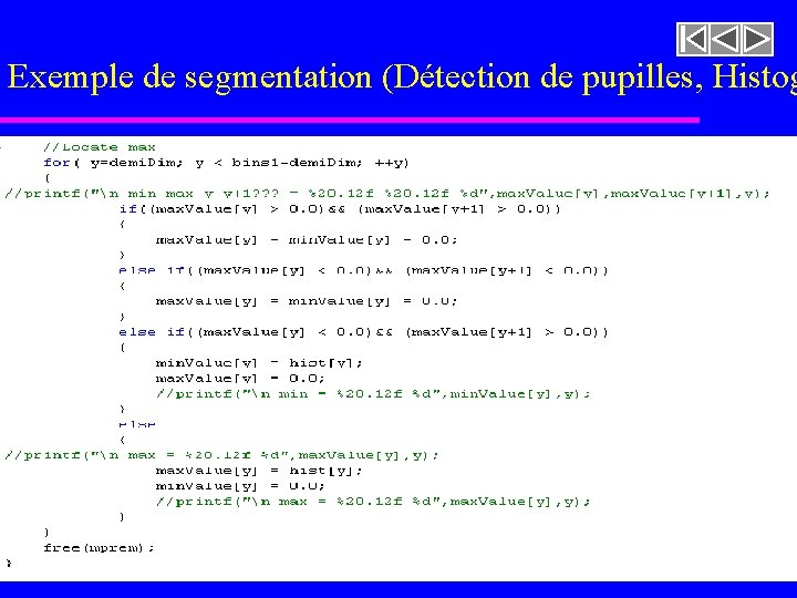 Exemple de segmentation (Détection de pupilles, Histog imageasegmenter. rast 