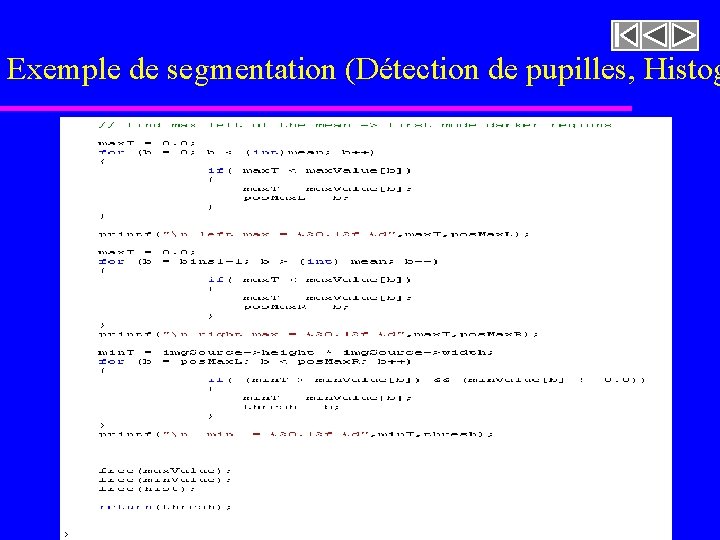 Exemple de segmentation (Détection de pupilles, Histog imageasegmenter. rast 