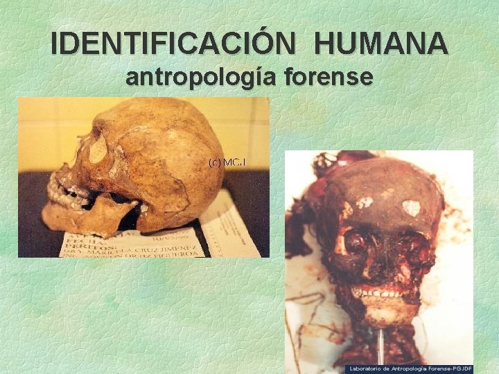 IDENTIFICACIÓN HUMANA antropología forense 