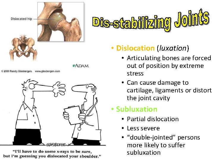  • Dislocation (luxation) • Articulating bones are forced out of position by extreme