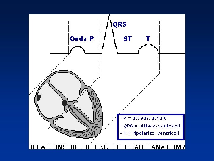 QRS Onda P ST T - P = attivaz. atriale - QRS = attivaz.