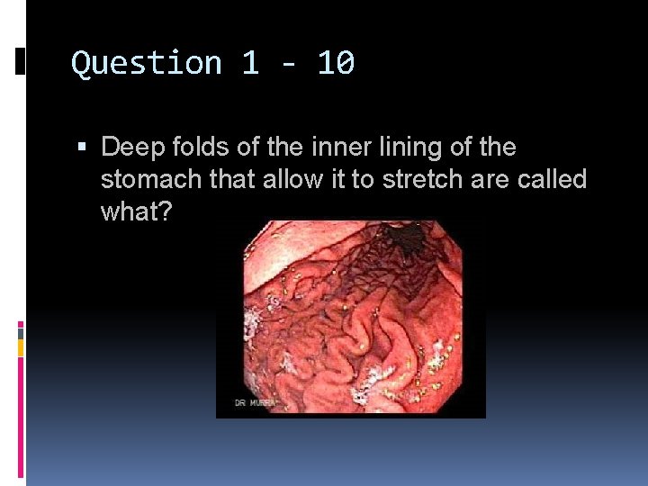 Question 1 - 10 Deep folds of the inner lining of the stomach that