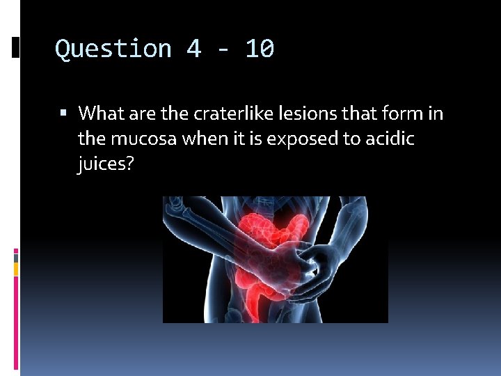 Question 4 - 10 What are the craterlike lesions that form in the mucosa