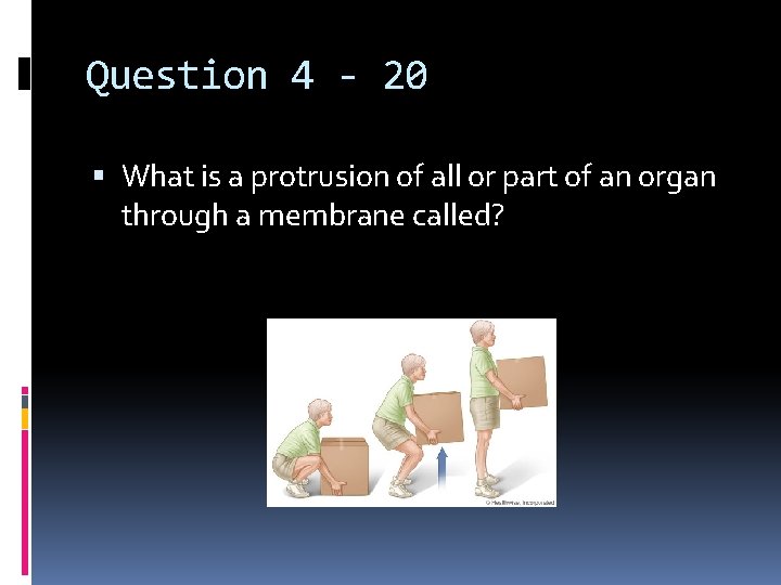 Question 4 - 20 What is a protrusion of all or part of an