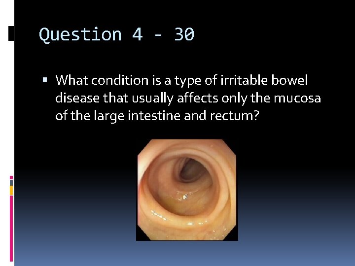 Question 4 - 30 What condition is a type of irritable bowel disease that