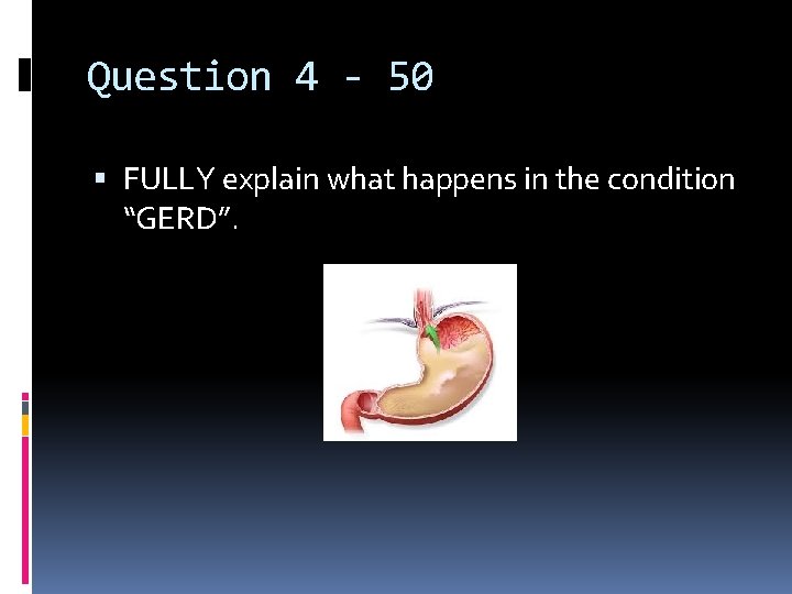 Question 4 - 50 FULLY explain what happens in the condition “GERD”. 