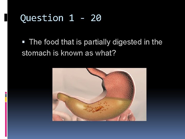 Question 1 - 20 The food that is partially digested in the stomach is