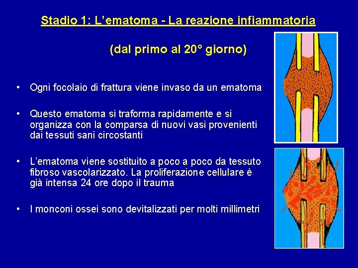 Stadio 1: L’ematoma - La reazione infiammatoria (dal primo al 20° giorno) • Ogni