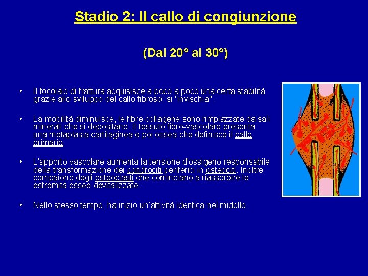 Stadio 2: Il callo di congiunzione (Dal 20° al 30°) • Il focolaio di
