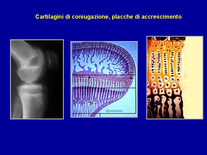 Cartilagini di coniugazione, placche di accrescimento 